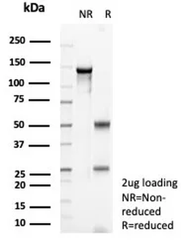 Recombinant SATB2 (Colorectal Carcinoma Marker) Antibody