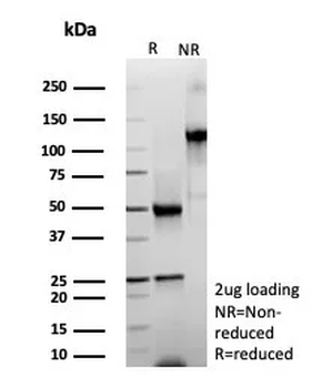 Recombinant Periostin (POSTN) Antibody