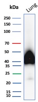 Recombinant Podoplanin (PDPN) (Lymphatic Endothelial & Mesothelial Marker) Antibody
