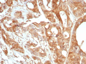 Recombinant Podoplanin (PDPN) (Lymphatic Endothelial & Mesothelial Marker) Antibody