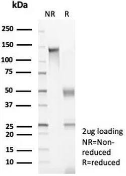 Recombinant Podoplanin (PDPN) (Lymphatic Endothelial & Mesothelial Marker) Antibody