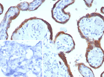 EBI3 / Epstein-Barr virus induced 3 Antibody