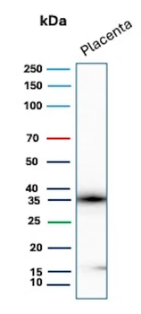 EBI3 / Epstein-Barr virus induced 3 Antibody