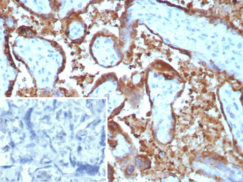 EBI3 / Epstein-Barr virus induced 3 Antibody