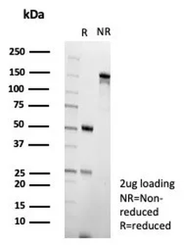EBI3 / Epstein-Barr virus induced 3 Antibody