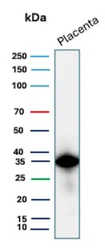 EBI3 / Epstein-Barr virus induced 3 Antibody