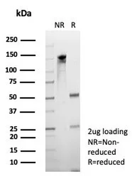 EBI3 / Epstein-Barr virus induced 3 Antibody