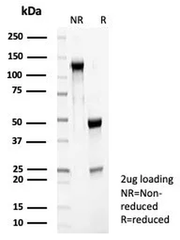 RET Antibody