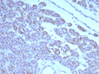 RET Antibody