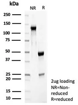RET Antibody