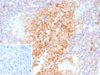 SERPINA1 Antibody