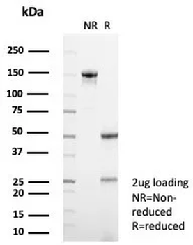SERPINA1 Antibody