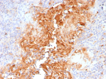 SERPINA1 Antibody