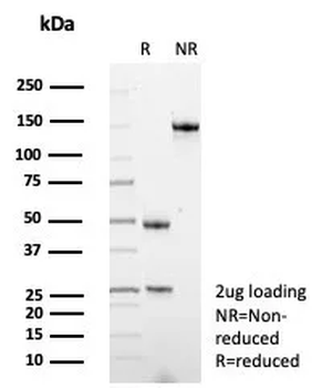 SERPINA1 Antibody