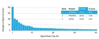 Alpha-1-Antitrypsin (SERPINA1) (Hepatocellular & Histiocytic Marker) Antibody