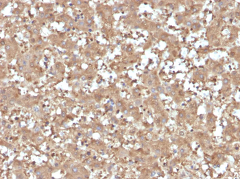 Alpha-1-Antitrypsin (SERPINA1) (Hepatocellular & Histiocytic Marker) Antibody