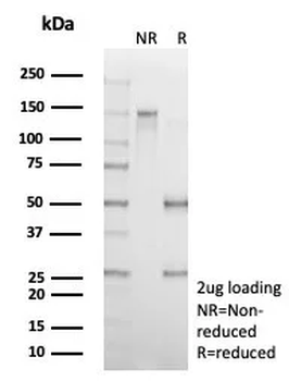 Alpha-1-Antitrypsin (SERPINA1) (Hepatocellular & Histiocytic Marker) Antibody