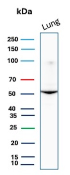 Alpha-1-Antitrypsin (SERPINA1) (Hepatocellular & Histiocytic Marker) Antibody
