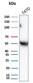 Alpha-1-Antitrypsin (SERPINA1) (Hepatocellular & Histiocytic Marker) Antibody