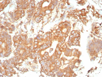 SERPINA1 Antibody