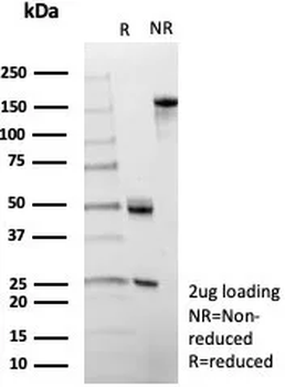SERPINA1 Antibody