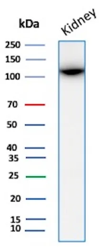 CD10 (Membrane Metalloendopeptidase) Antibody