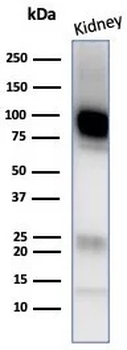 CD10 (Membrane Metalloendopeptidase) Antibody