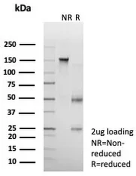 NR3C2 Antibody
