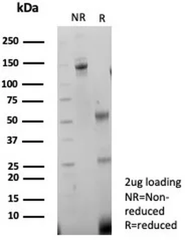 Recombinant CD56 / NCAM1 / NKH1 (Neuronal Cell Marker) Antibody