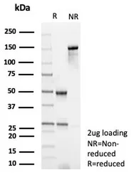 Recombinant Periostin (POSTN) Antibody