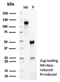 RET Antibody