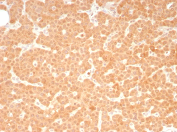 RET Antibody
