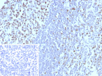 MCM3 Antibody