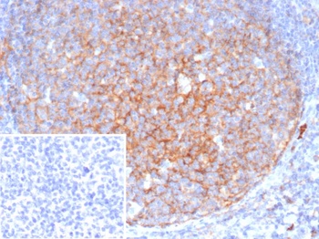 CD11b / MAC-1 (Microglial Marker) Antibody