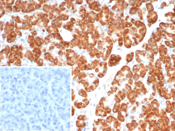 IL-6 (Interleukin-6) / Interferon beta-2 (Hybridoma Growth Factor) Antibody