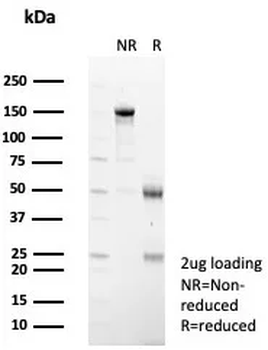 IL1RN Antibody