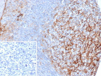 CD54 / ICAM-1 Antibody