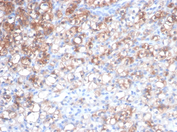 HSPB1 Antibody
