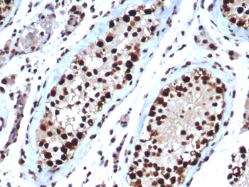HSPA1B Antibody