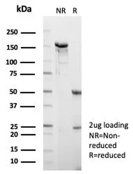 HSPA1B Antibody