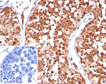 HSPA1A Antibody