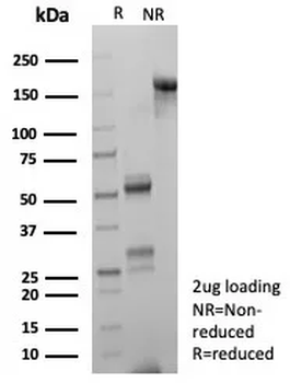 HSPA1A Antibody