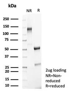 MR1 / Major histocompatibility complex, class I-related Antibody