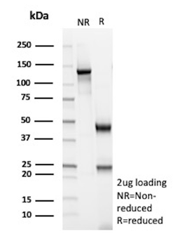 Recombinant Glutamine Synthetase / GLUL Antibody