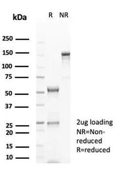 GFAP (Astrocyte & Neural Stem Cell Marker) Antibody