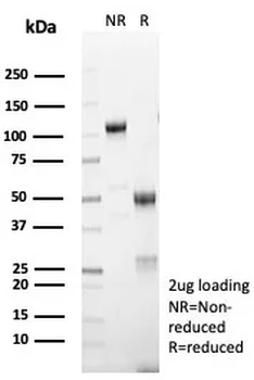 Recombinant MART-1 / Melan-A / MLANA (Melanoma Marker) Antibody