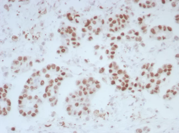 ERCC1 Antibody