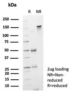 ERCC1 Antibody