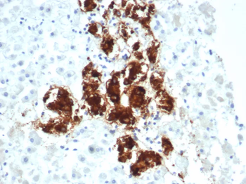 DBH / Dopamine Beta-Hydroxylase Antibody