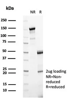 DBH / Dopamine Beta-Hydroxylase Antibody